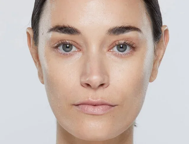 Restylane_CategoryPage_BABanner_Georgia_After