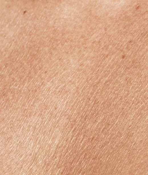 concerns_dryskin_dryskincanhappen