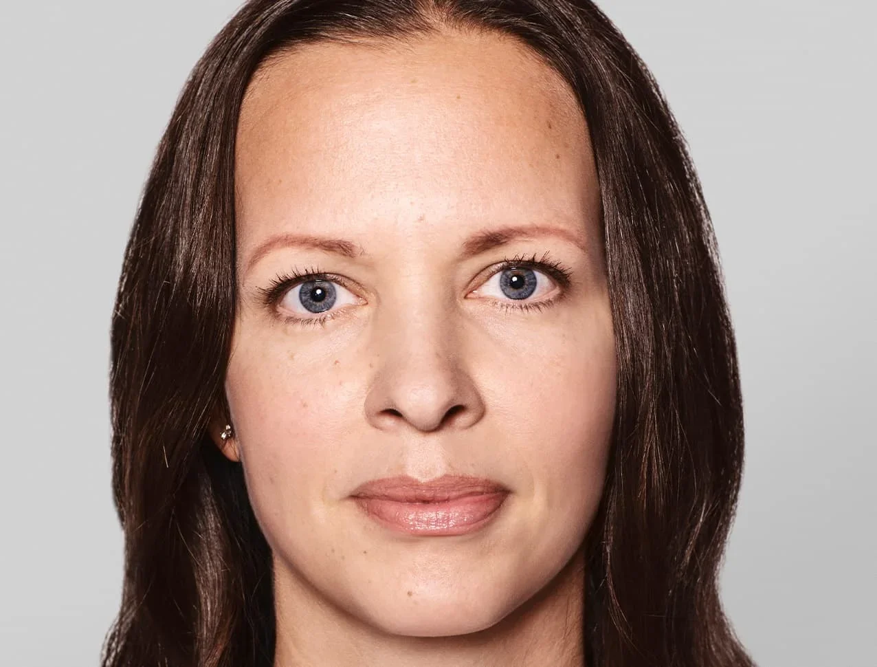 consumer_v3_skinboosters_face_basmall_anna_before