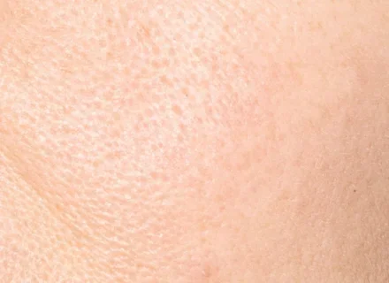 skin_texture