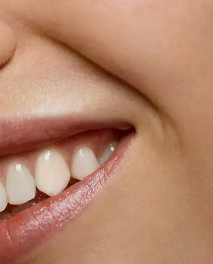 rugas-labios-linhas-finas.jpg