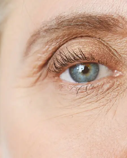 rugas nos olhos