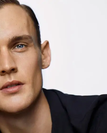 Homens podem destacar o contorno facial com ácido hialurônico Restylane® 